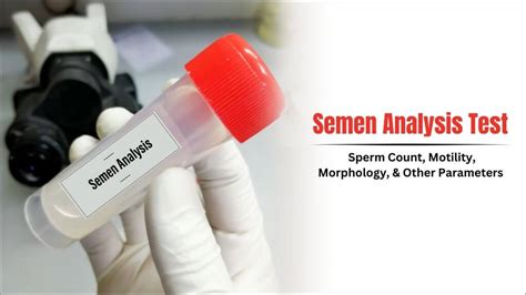 sperm analysis test near me